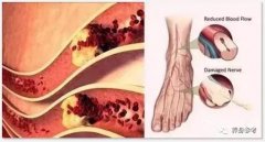 Ѫܶû£֪ÿΣѪ˨ˢ~